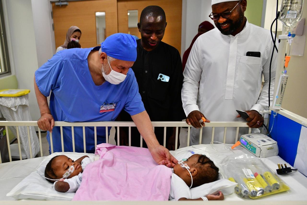 Read more about the article Saudi hospital successfully separates conjoined Nigerian twins