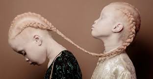 Albinism: First Lady reaffirms support for inclusive policies