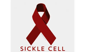 Examining Nigeria’s approach to defeating Sickle Cell Disease