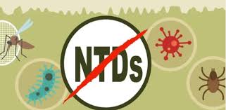 30m Nigerians treated for NTDs – FG