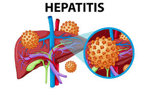 Nigeria’s fight to eliminate hepatitis in prisons
