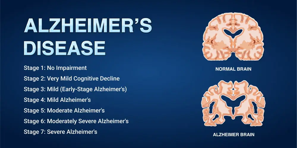 2025 Alzheimer’s Day: Silver-Cross hospital conducts free medical screening