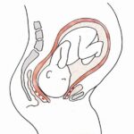 FG frees 1,600 women from obstetric fistula burden, says NHIA
