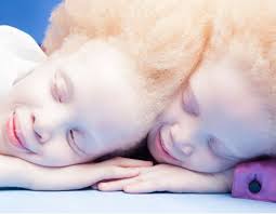 Commission distributes free sunscreens to 100 persons with albinism