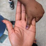 C’River Govt. vows to make state measles-rubella free