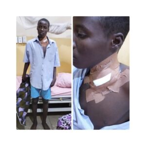 Kaduna teen survives attack, hails Army Hospital’s life-saving treatment