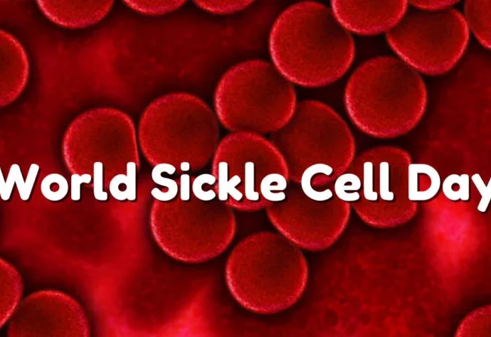 For the illustration of World Sickle Cell Day