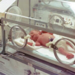 A newborn being managed of jaundice