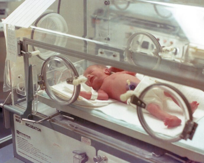 A newborn being managed of jaundice