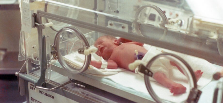 A newborn being managed of jaundice