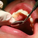 Dental care in Nigeria