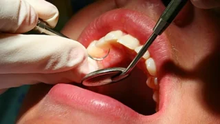 Dental care in Nigeria