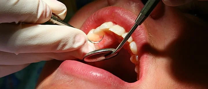 Dental care in Nigeria